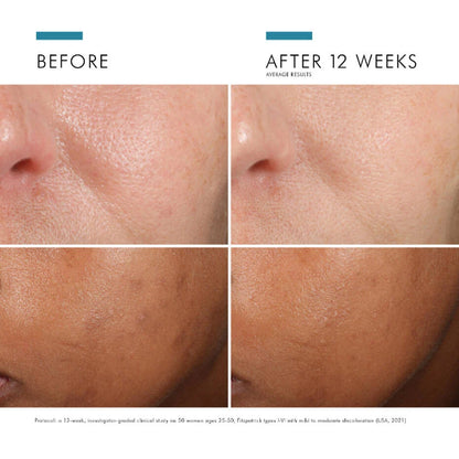 Phloretin CF Serum